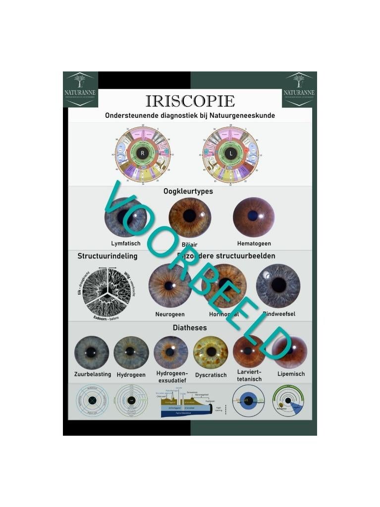 Poster iridology, Verzamelen, Posters, Nieuw, Overige onderwerpen, Deurposter of groter, Rechthoekig Staand, Ophalen of Verzenden