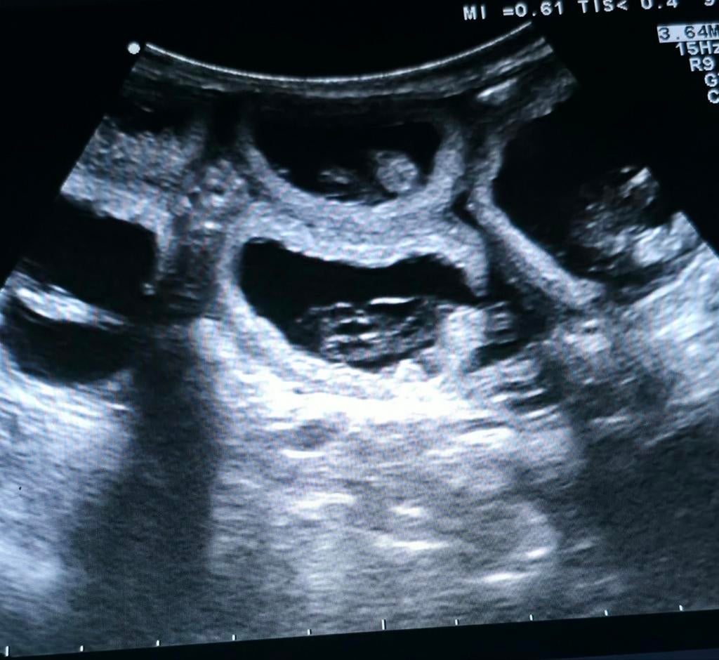 🐶🍼 drachtecho laten maken van uw teefje? 🐶🍼, Verzorging