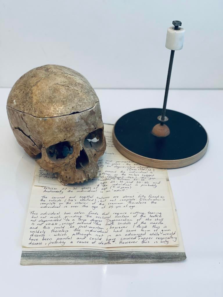 Gezocht! Mensenschedel / Schedel Mens / Skelet / Educatief, Ophalen of Verzenden, Zo goed als nieuw