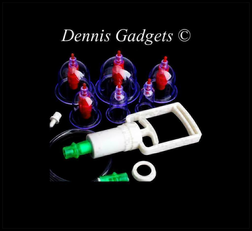 Dennis Gadgets :Chinese Cuppingset ( 12 Cups ) of ( 6 Cups), Sport en Fitness, Massageproducten, Ophalen of Verzenden, Nieuw, Overige typen