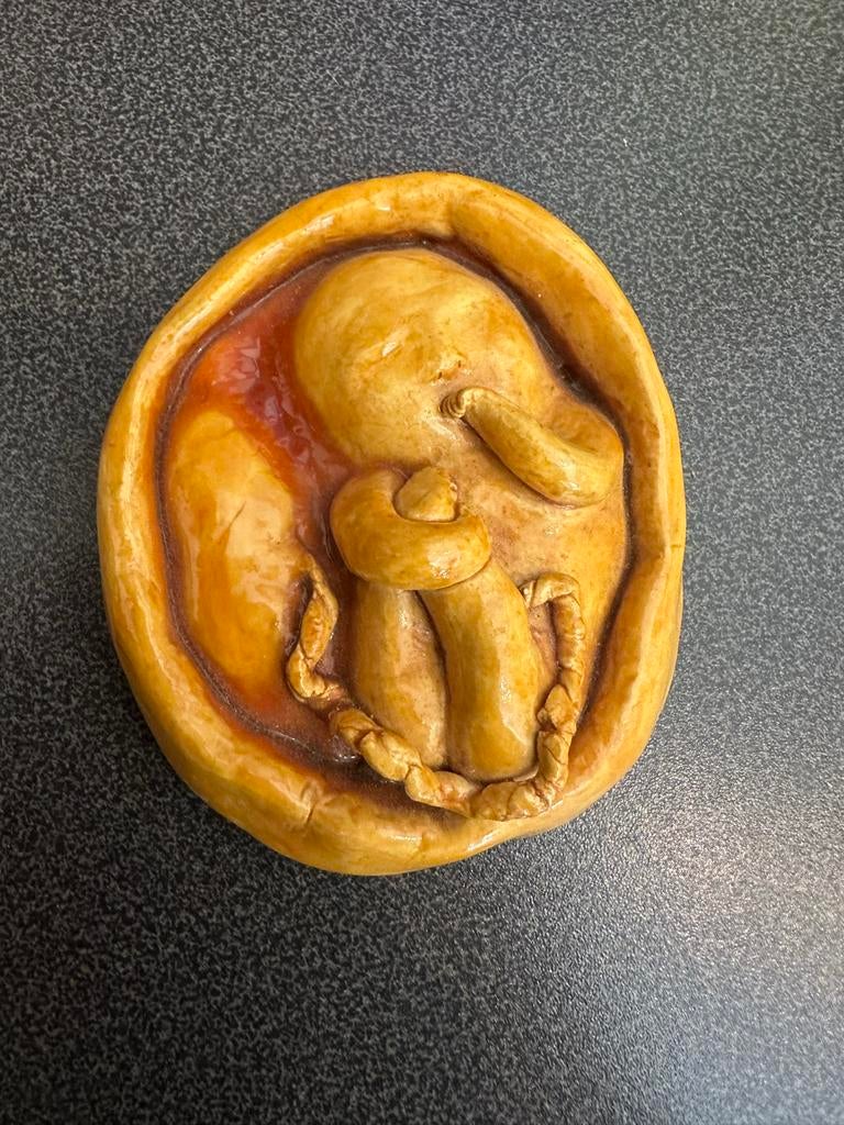 Pro-life wandbordje, Antiek en Kunst, Ophalen of Verzenden