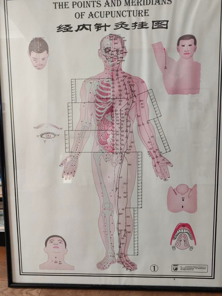Acupunctuurpunten Poster - Ingelijst 60x80cm, Ophalen of Verzenden