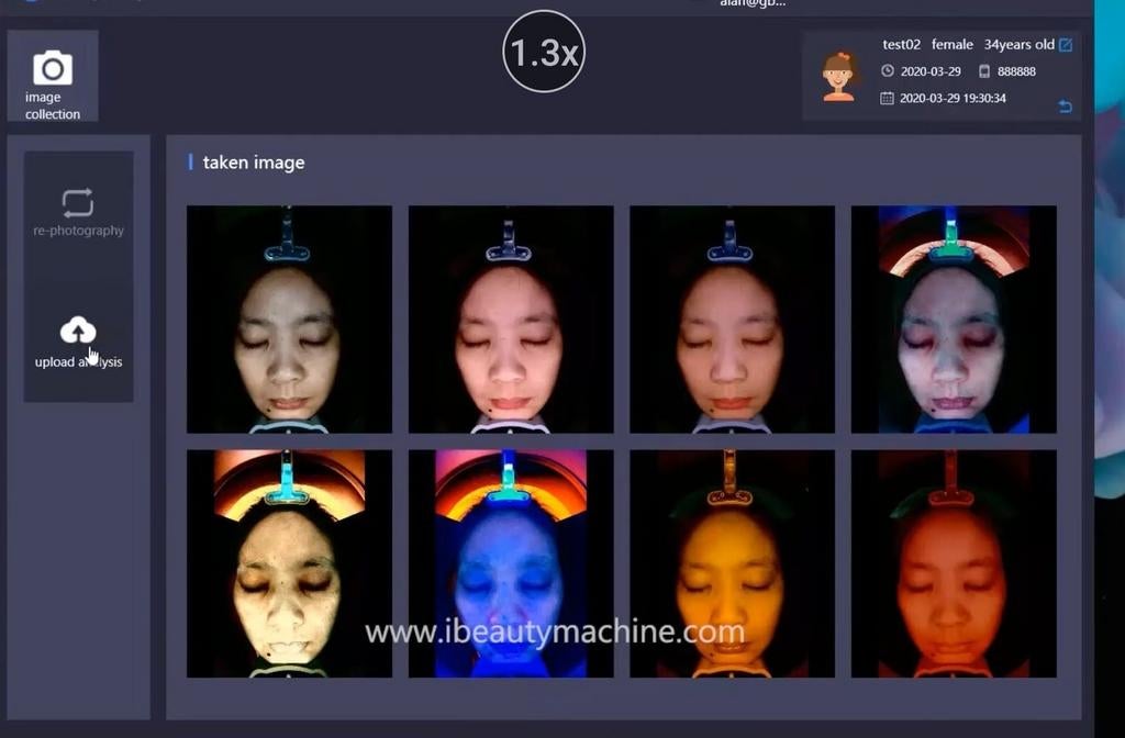 High Tech huid analyse, Ophalen of Verzenden