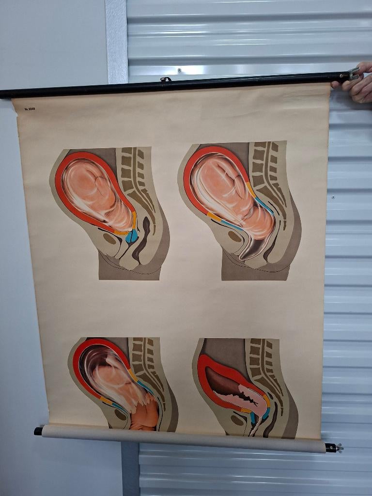 Prachtige oude schoolplaten Anatomie, Verzamelen, Ophalen of Verzenden, Gebruikt