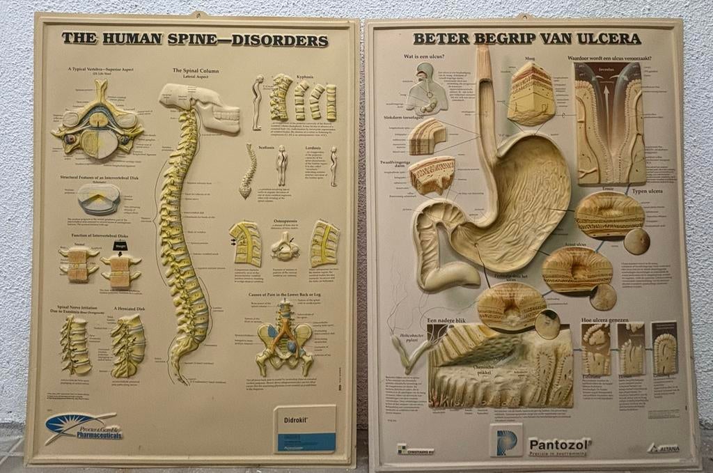 Anatomische Modellen: Ruggengraat & Ulcera, Ophalen of Verzenden, Natuur en Biologie