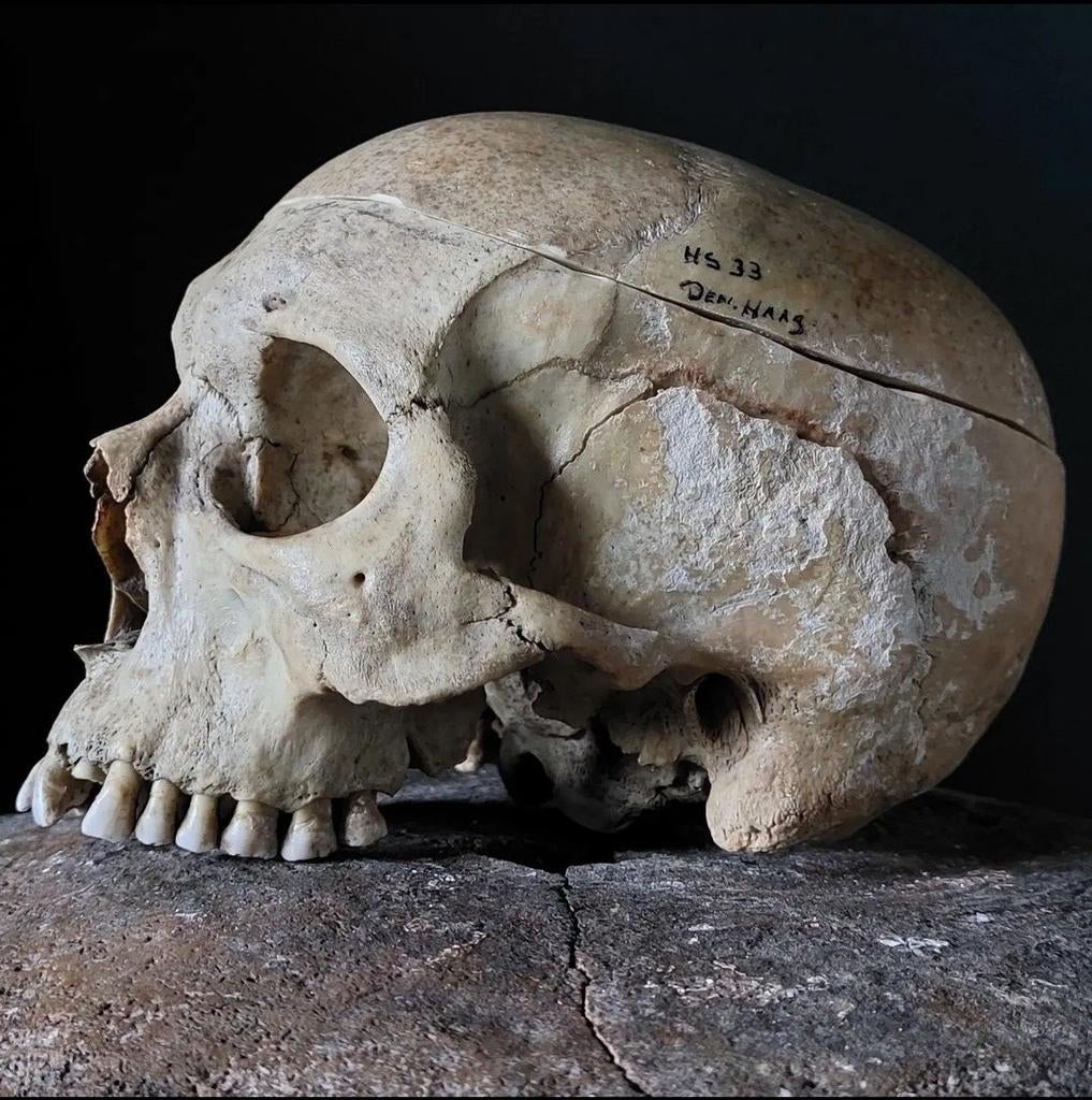 Schedel mens gevraagd, voor educatief doel. mensenschedel, Ophalen of Verzenden