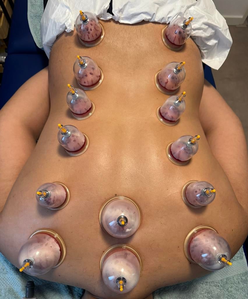 Hijama cupping en massage, Ontspanningsmassage