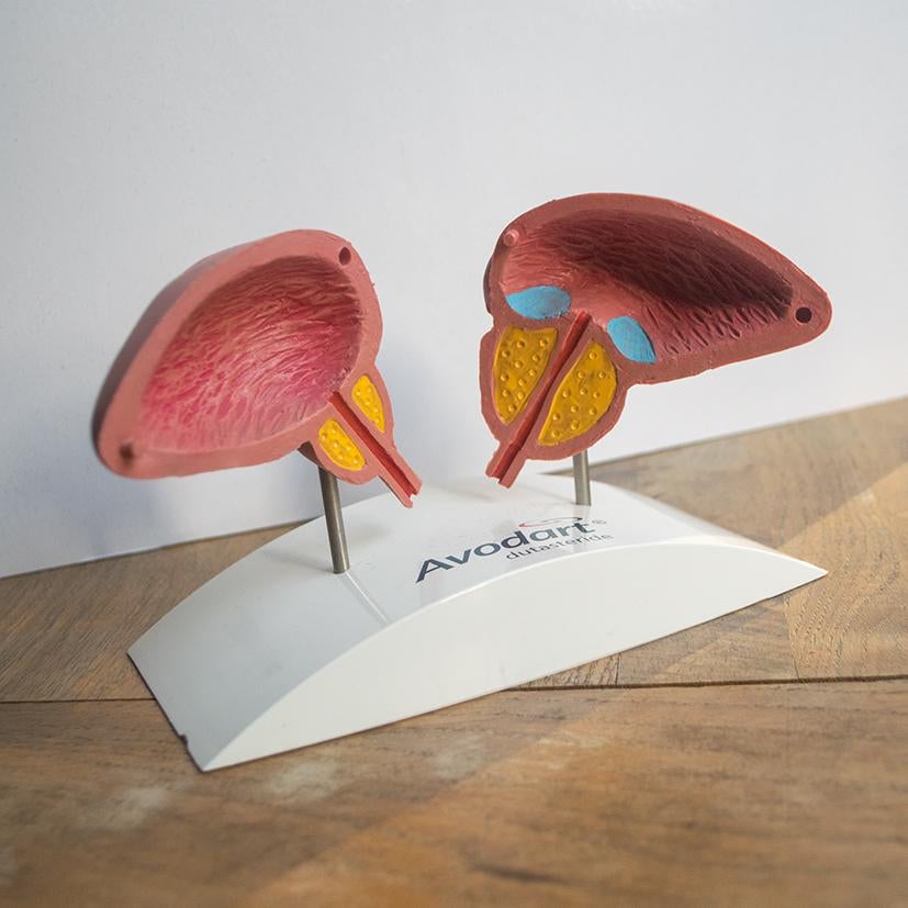 Anatomiemodel prostaat, anatomie model biologie man, Ophalen of Verzenden
